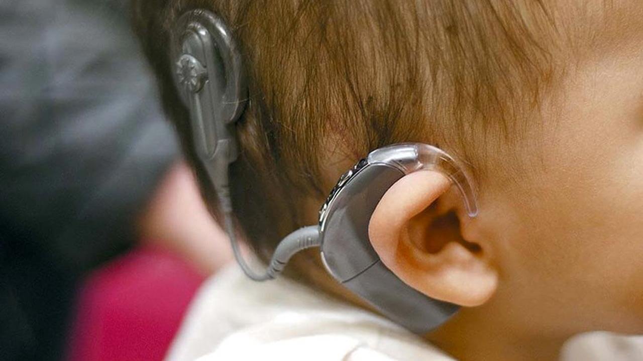 Cochlear Implants Hyderabad